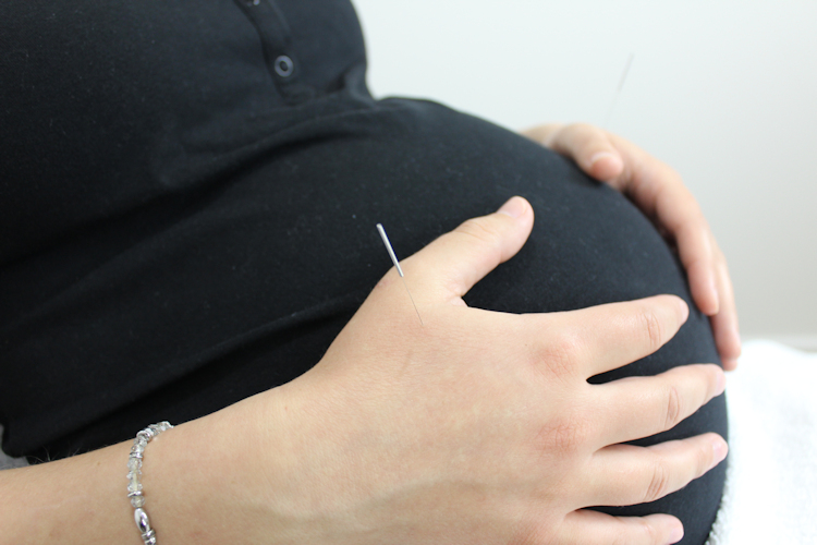 Acuflex Holistics - Acupuncture for Fertility