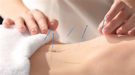 Acuflex Holistics - Acupuncture for Menstrual and Menopausal Disorders