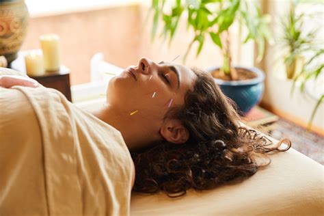 Acuflex Holistics - Acupuncture for Stress, Anxiety and Headaches/Migraines
